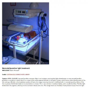 9W 52 2P UV-B PL-S sijalka - Medicinska terapija za zlatenico 8222-18221